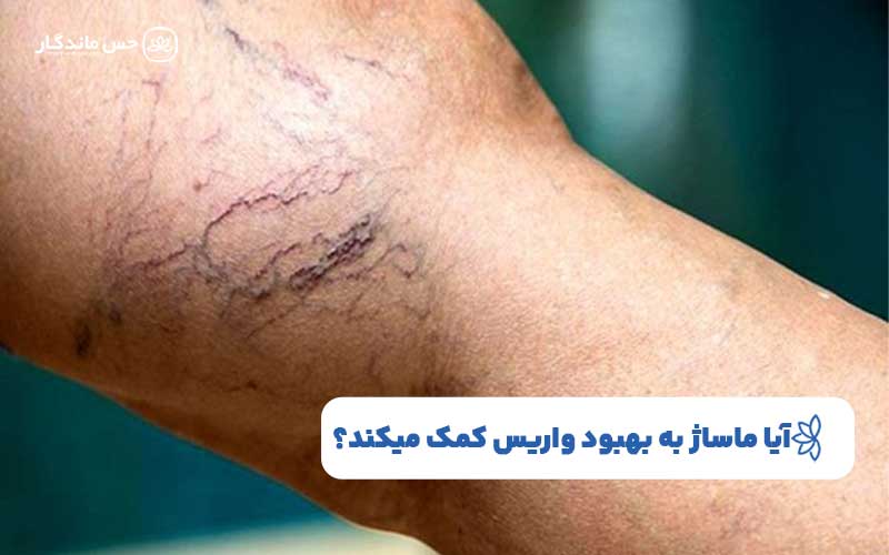آیا ماساژ به بهبود واریس کمک میکند؟
